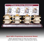 3 Stages of Spinal Degeneration