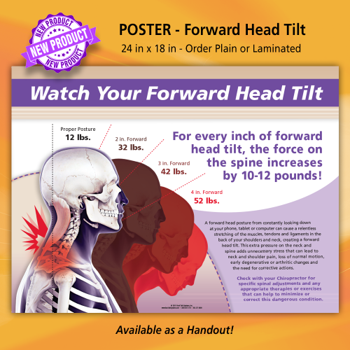 Poster - Forward Head Tilt