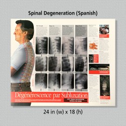 Poster - Spinal Degeneration (French or Spanish)